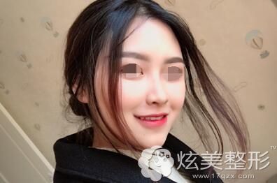 北京圣贝口腔牙齿正畸案例
