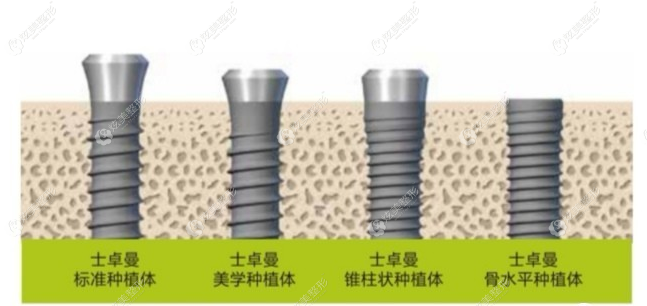 瑞士iti种植体的特点