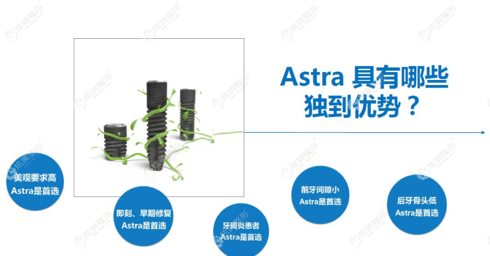 瑞典astra种植体的优势