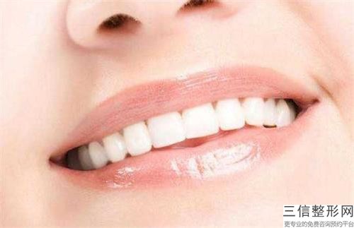 2023年杭州市牙齿陶瓷矫正价格表2023版正式公开-杭州市牙齿陶瓷矫正均价为：15670元