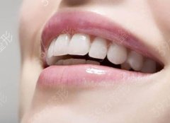矫正牙齿一般多少钱？可以改变脸型吗？