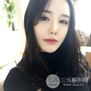 南京美莱陈天杰自体脂肪填充全脸 女神的养成记！