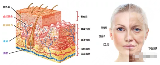 5d胶原光是什么