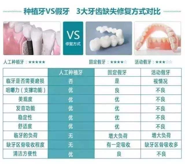 国产种植牙多少钱