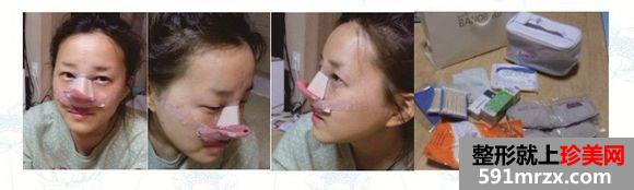 长沙雅美医疗美容医院隆鼻怎么样