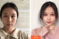 北京加减美医疗美容门诊部穆宝安整形价格表附皮肤美容案例果