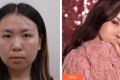 北京雅靓医疗美容诊所金昌义（韩）整形价格表附隆鼻手术案例果