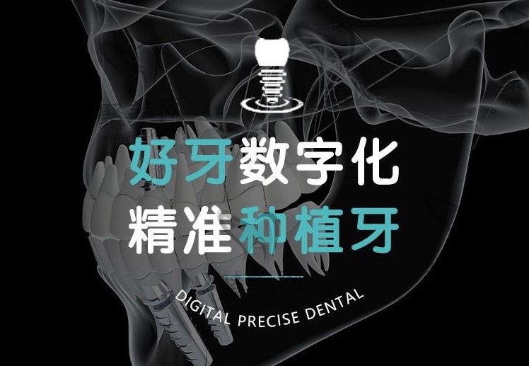 如何预约北京好牙口腔种植牙优惠活动？