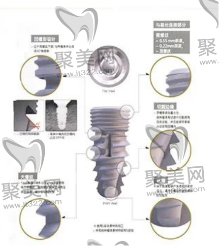 韩国ibs的优势