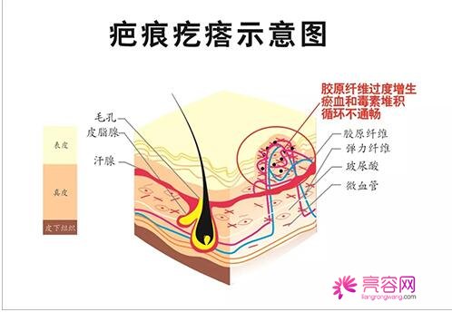 甘肃省人民医院激光祛疤果反馈：告别疤痕，重获光滑肌肤~