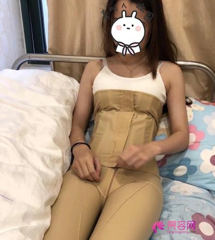 上海臻妮沈莺莺技术如何？医生综合实力介绍|内附吸脂减肥真实手术案例