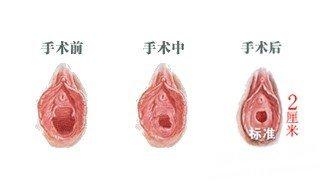 宜昌处女膜修复医院去哪里