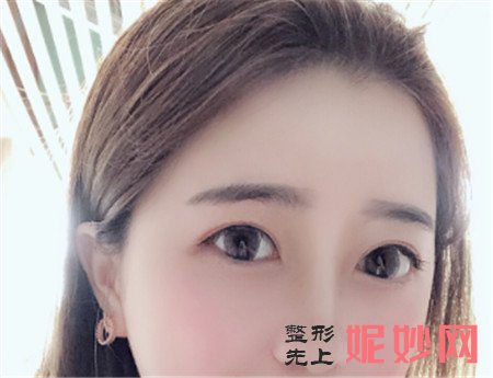 术后照