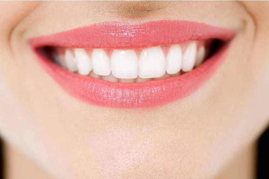 牙齿美白|我这一口氟斑牙怎么去除?变白? 牙齿美白|我这一口氟斑牙怎么去除?变白?