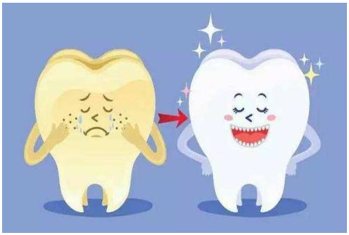 超薄牙贴面|悄悄改变,惊艳所有人! 超薄牙贴面|悄悄改变,惊艳所有人!