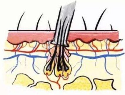 引起毛囊坏死的原因是什么呢