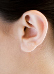耳廓畸形是怎么样的
